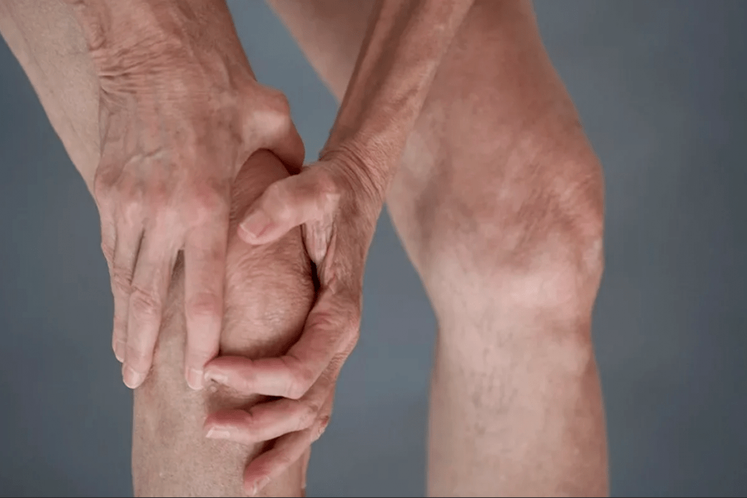 Les douleurs articulaires peuvent être la cause de l'arthrose ou de l'arthrite. 