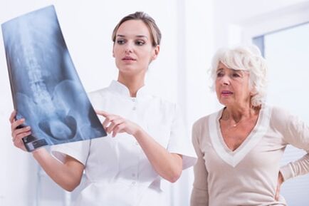 L'examen aux rayons X est un moyen informatif de diagnostiquer l'ostéochondrose de la colonne vertébrale. 