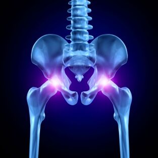La douleur dans les articulations de la hanche peut être aiguë, douloureuse ou chronique. 
