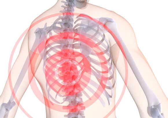 L'ostéochondrose thoracique s'accompagne de maux de dos, une douleur vive qui contracte les muscles. 