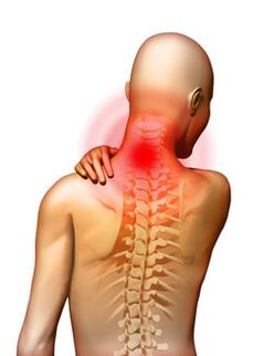 La douleur est le principal symptôme de l'ostéochondrose cervicale.