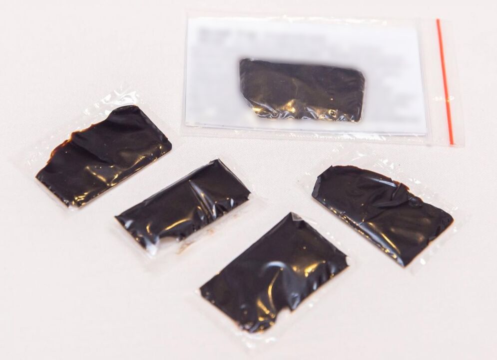 Shilajit est un remède efficace pour le traitement de l'ostéochondrose cervicale à domicile.